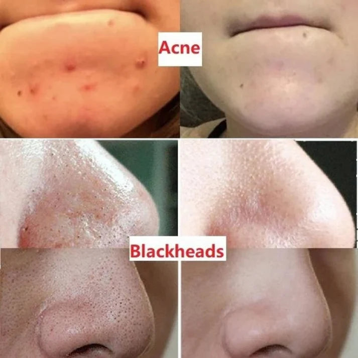 Aroxens Green Tea Deep Cleanse Mask Stick