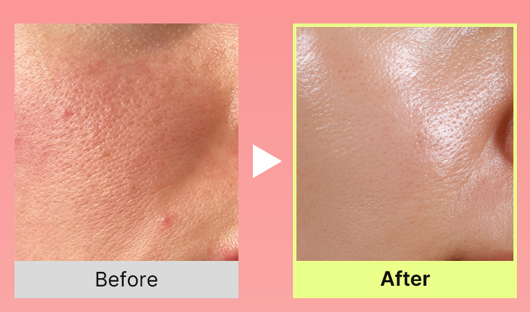 Aroxens Wrinkle Bounce Multi Balm
